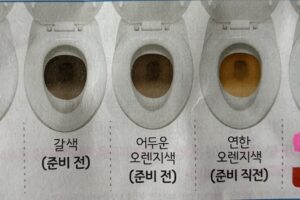 대장내시경, 위내시경 동시에 받은 후기 및 비용은?