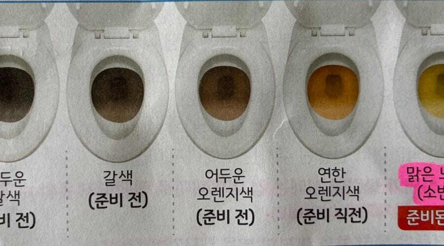 대장내시경, 위내시경 동시에 받은 후기 및 비용은?